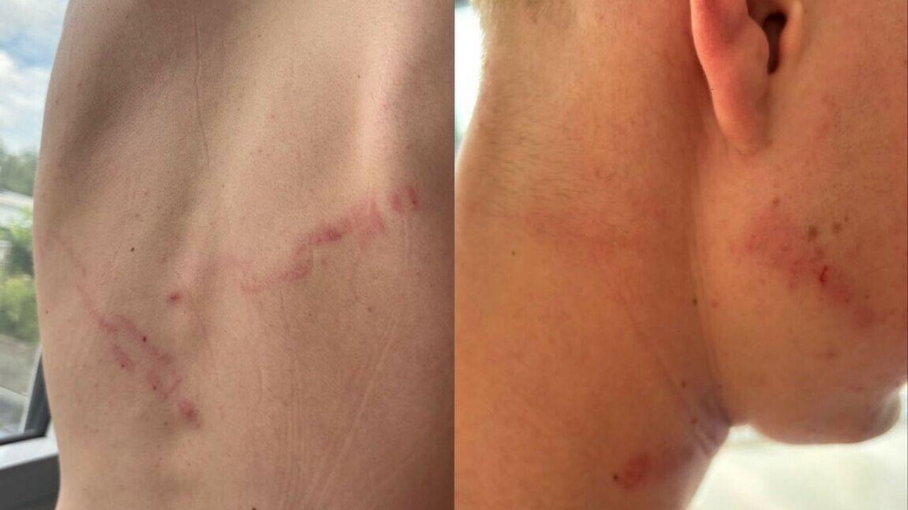 Mishandeling Gouden Pijl